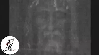 A Closer Look at The Shroud of Turin