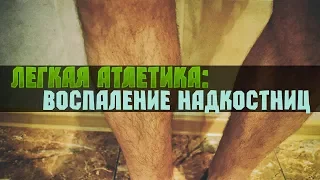 Легкая Атлетика: Воспаление надкостницы (Шинсплинт). Лечение.