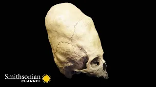 Evidence of an Ancient Horrifying Practice 💀 Riddle Of The Roman Skulls | Smithsonian Channel