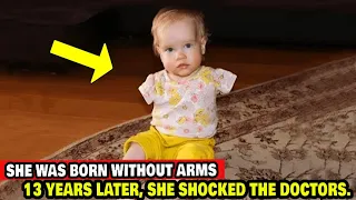 She Was Born Without Arms, And 13 Years Later, She Shocked The Doctors.