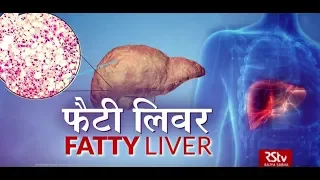 Ayushman Bhava: फैटी लिवर | Fatty liver