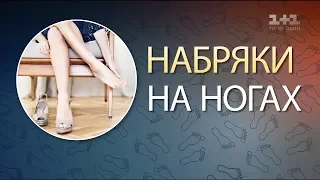 Чому набрякають кінцівки і як це вилікувати - лікар Ростислав Валіхновський