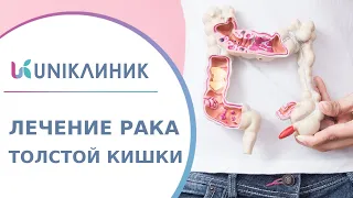 🔎 Рак ободочной кишки: первые симптомы, диагностика, лечение. Лечение рака ободочной кишки. 18+