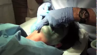 ZO Dr Obagi   Controlled Depth Peel Blue Peel   2