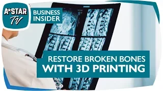 Fixing Broken Bones with 3D Printing - A Project with Osteopore