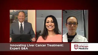 Innovating Liver Cancer Treatment: Expert Q&A