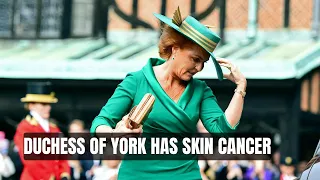 Duchess of York Sarah Ferguson Has Aggressive Skin Cancer