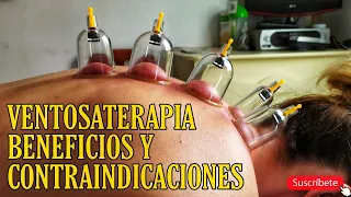 Ventosaterapia, Beneficios y Contraindicaciones