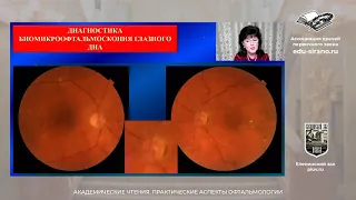 Диабетическая ретинопатия: ранняя диагностика, особенности клинического течения
