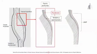 Manejo de las lesiones musculares del deportista. anatomía de las lesiones musculares.