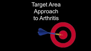 Target Area approch to arthritis