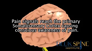 3 Level DLDR of the Cervical Spine