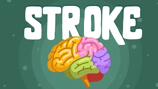 STROKE // Act FAST