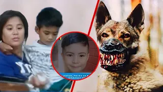 Ang Batang Kinagat ng Aso at Nagsimulang Tumahol kapag lalapit ang Doctor