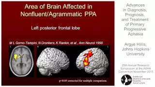 Argye Hillis: Advances in Diagnosis, Prognosis, and Treatment of Primary Progressive Aphasia