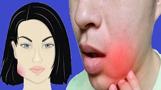 Swollen Cheek: Causes And Prevention