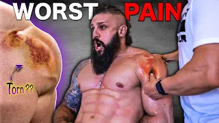 The WORST PAIN: We TORE My SHOULDER MUSCLE On Camera! | Can INSTANT Trigger Point Massage FIX IT?!