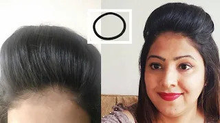 1 min front #puff for thin hair/easiest way to make front PUFF|PUFF HAIRSTYLE WITH RUBBER BAND