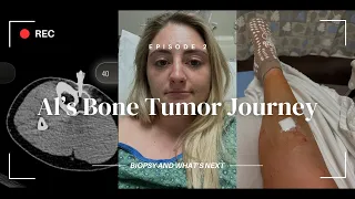 Al's Bone Tumor Journey | Episode 2 - The Biopsy Procedure