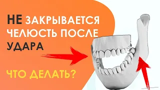 Челюсть НЕ ЗАКРЫВАЕТСЯ после удара: Что делать, Как лечить, Когда пройдет