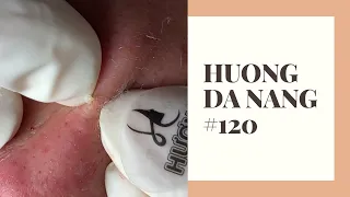 #120 | Huong Da Nang