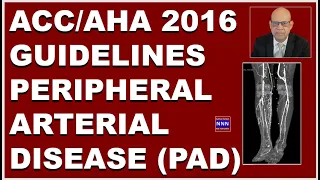 ACC AHA Guidelines 2016 Peripheral Arterial Disease Dr. Nik Nikam