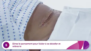 Comment appliquer et retirer un pansement Aquacelᴹᴰ Ag Surgical (césarienne)