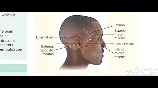 Middle meningeal artery 2