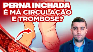 Perna inchada: como resolver a má circulação e trombose? Qual risco de embolia ou outra complicação?