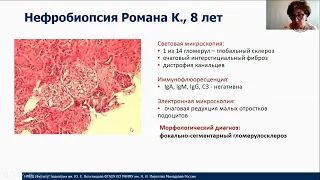 "Вельтищевские пятницы" Болезнь Дента: нераспознанная причина протеинурии