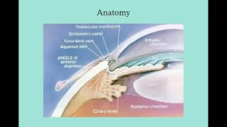 Uveitis   CRASH! USMLE Step 2 and 3