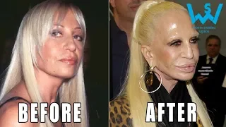 Top 10 Before And After Celebrity Plastic Surgery Fails That Will Scare You