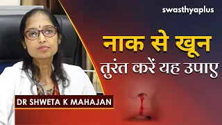 नाक से खून आने पर तुरंत करें यह उपाए  | Dr Shweta K Mahajan on Nose Bleeding in Hindi | Epistaxis