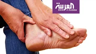 صباح العربية | ما أسباب تورم القدمين؟