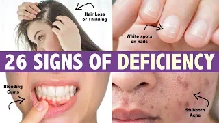 26 Signs Your Body is Deficient in VITAL Nutrients *life changing*