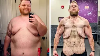 Real People Who Lost Too Much Weight