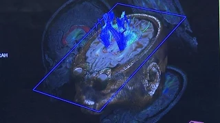 Space Station Live: MRI for Astronaut Vision Research