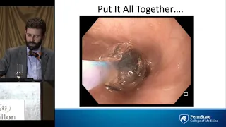Endoscopic Management of Surgical Complications - Dr Eric Pauli