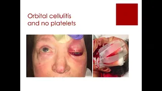 USC Caruso Department of Otolaryngology – Head and Neck Surgery: Grand Rounds (03/05/2021)