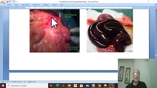 Hernia in Arabic 8 ( Strangulated hernia , part 3) , by Dr.Wahdan