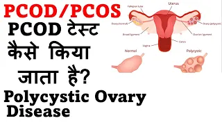 PCOD test in Hindi | PCOD and PCOS test kaise hota hai ?