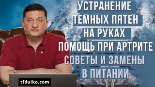 Устранение темных пятен на руках, Помощь при артрите: советы и замены в питании