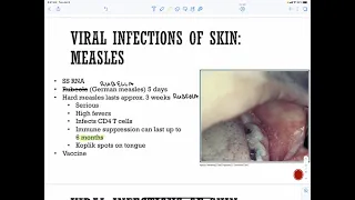 Viral infections of the skin