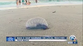 5 people stung by man-o-war at Phil Foster Park