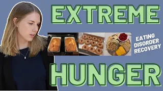 Dealing with EXTREME HUNGER in Eating Disorder Recovery