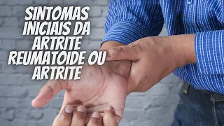 sintomas iniciais da artrite reumatoide ou artrite