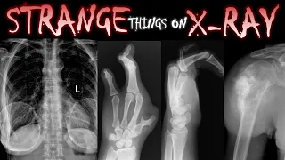 Strange Things on X-Ray 👽🩻 #xray #radiology #medical