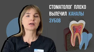 Последствия⛔️Стоматолог плохо вылечил каналы зубов