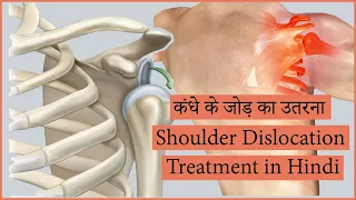 shoulder dislocation - dislocated shoulder, causes, signs and symptoms, diagnosis and treatment.