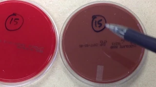 Plate Reading - Lower Respiratory II